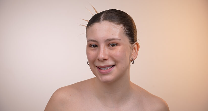 Módulo 01 - Pré Pele